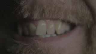 Crooked teeth stock footage